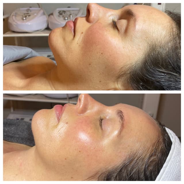 DMK Cellular Revision Package at Yarrow Skin Care Collective in Portland, OR