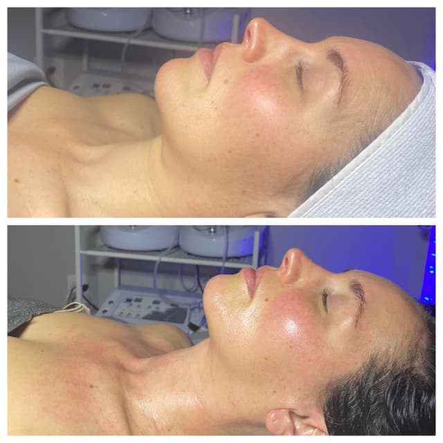 DMK Sculpt & Contour Package at Yarrow Skin Care Collective in Portland, OR